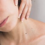 Une belle peau naturellement : quels aliment privilégier ?